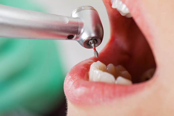 Best Emergency Treatment for Dental Infections or Abscesses in Independence, KS